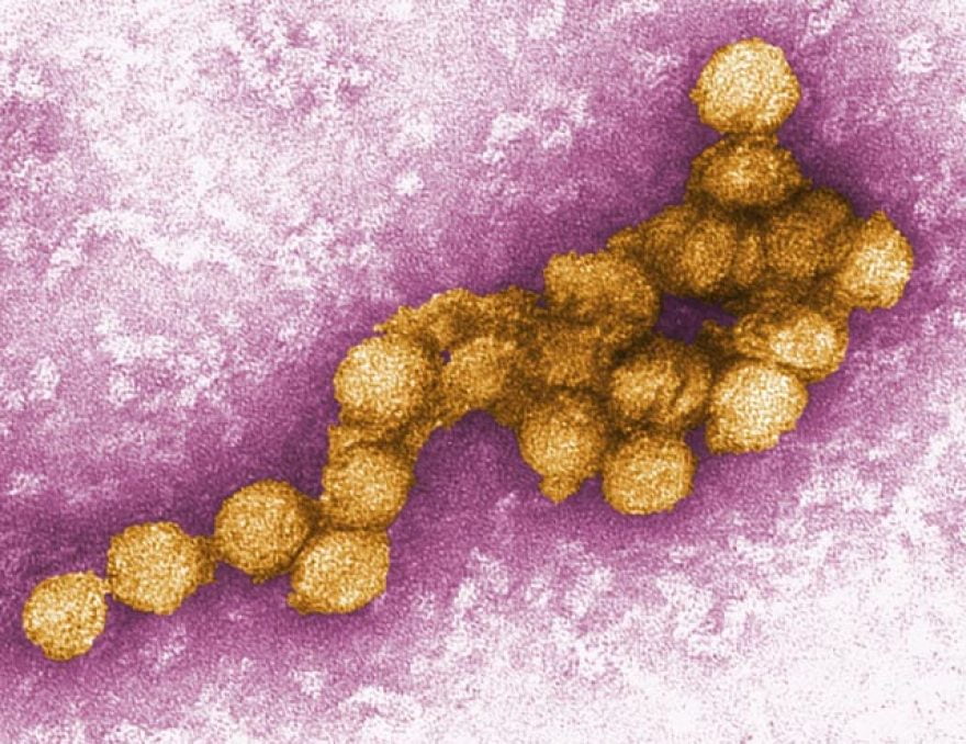 Virüsler Nedir? Virüslerin Keşfi Nasıl Olmuştur?